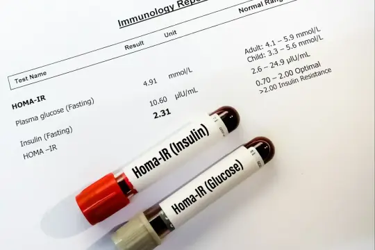 Wyniki badań HOMA-IR, w tym glukozy i insuliny na czczo, wskazują na potencjalną insulinooporność.
